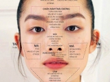 6 vị trí mụn mọc thường gặp trên gương mặt nói gì về tình trạng cơ thể bạn?